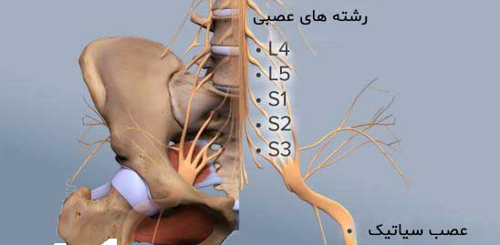 درد سیاتیک-3-رشته های عصبی